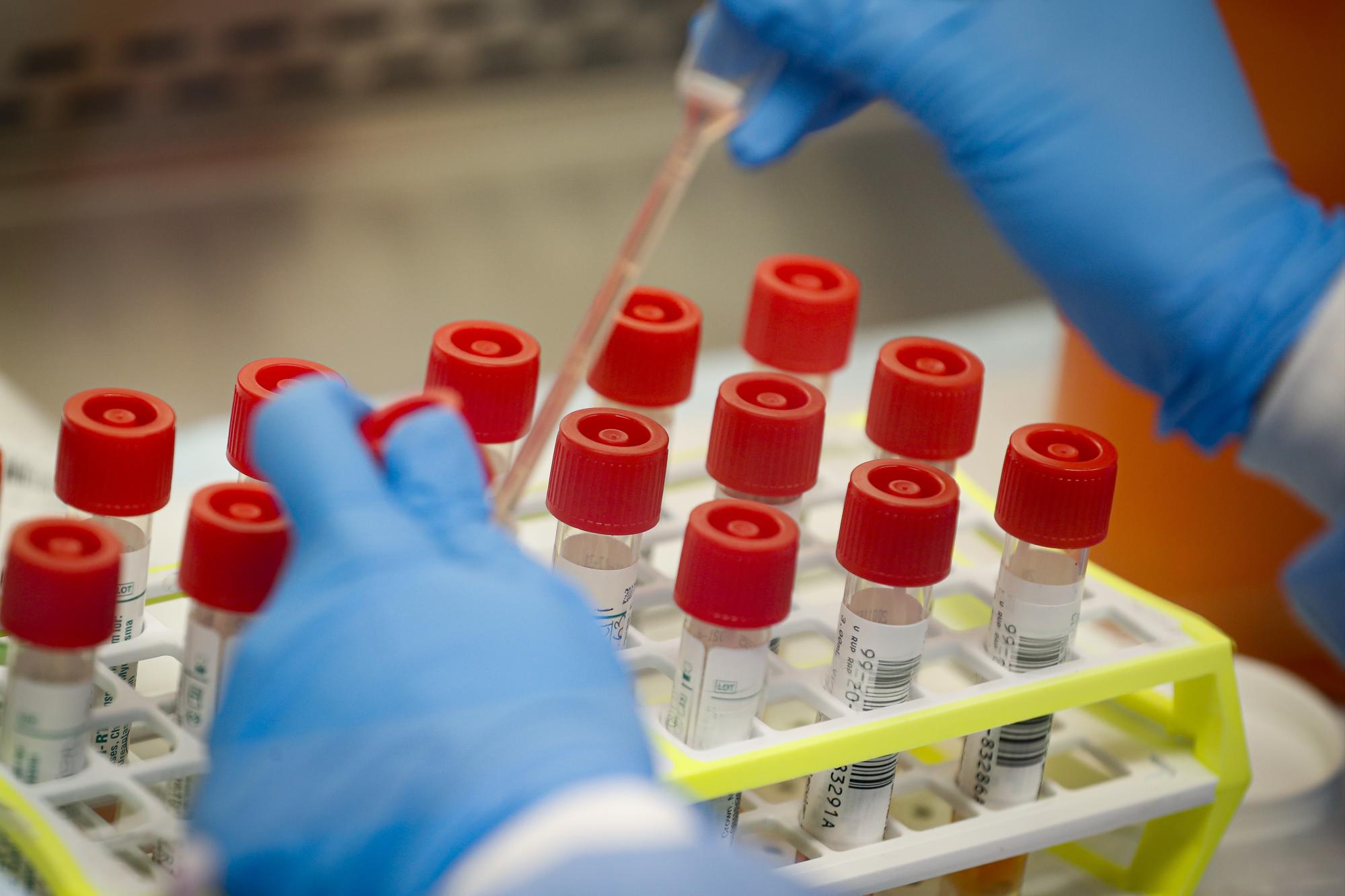 Pasos en falso demoran respuesta de EEUU al coronavirus Pasos en falso demoran respuesta de EEUU al coronavirus