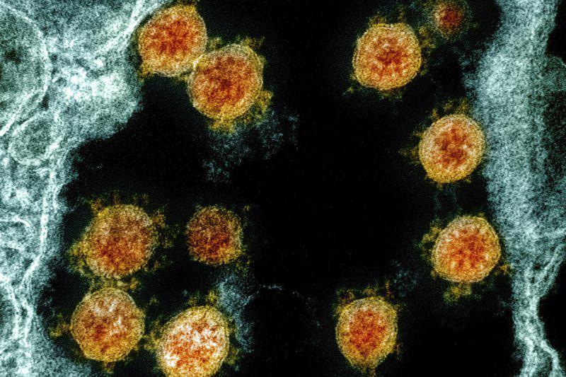Sistema inmunológico ofrece claves sobre reacción al virus