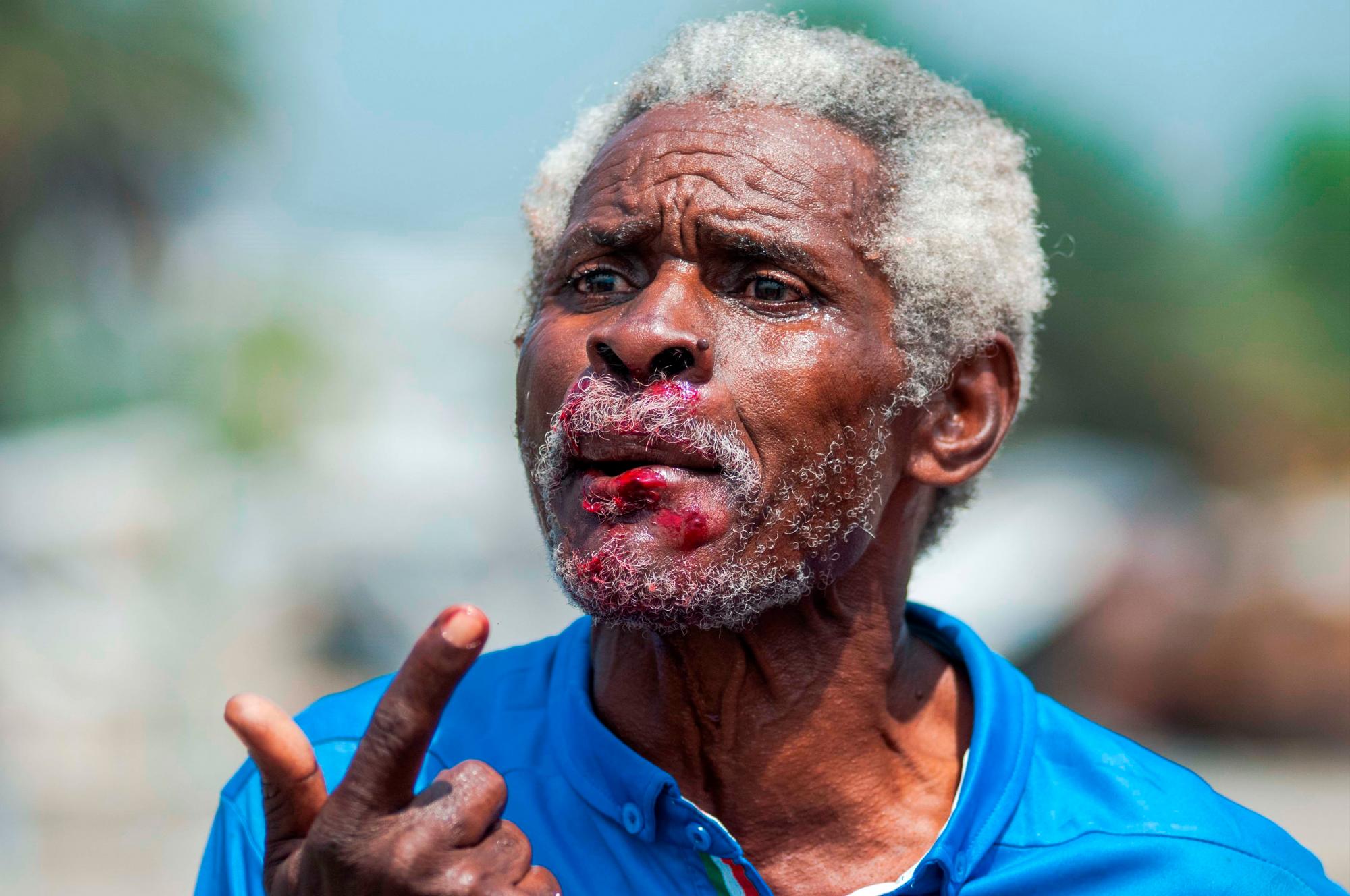 Un hombre resultó herido durante enfrentamientos entre manifestantes y la policía en Puerto Príncipe (Haití).