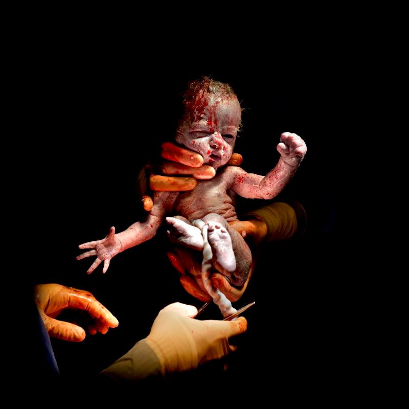 CESAR # 15 - Léanne. Nació el 8 de abril de 2014 a las 8:31 a.m. 1,7 kg, 13 segundos de vida.