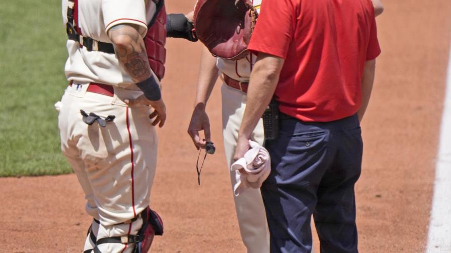 Molina se lastima rodilla; Cardenales caen ante Rojos Molina se lastima rodilla; Cardenales caen ante Rojos