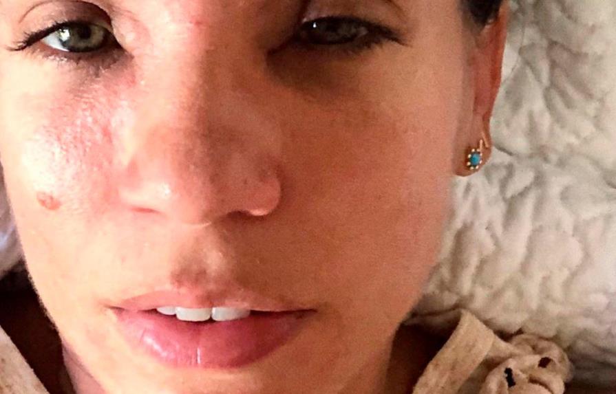Mejora la salud de Karina Larrauri tras inflamación en su cara por humo de Duquesa