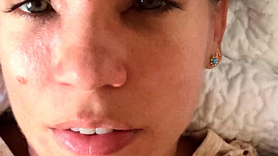 Mejora la salud de Karina Larrauri tras inflamación en su cara por humo de Duquesa