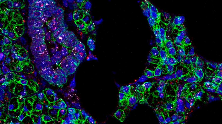 Muere de COVID-19 empleada del Senado