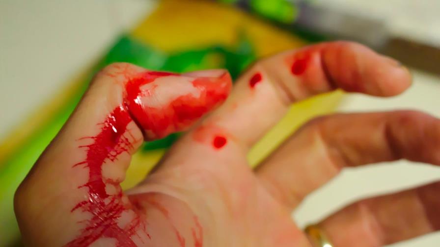 11 heridos en accidente de altos hornos en el norte México