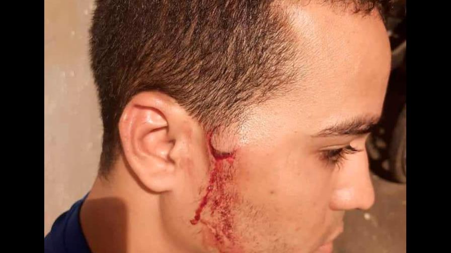 Denuncian patrulla PN y Ejército agrede hijo y sobrina de alcalde de Dajabón Denuncian patrulla PN y Ejército agrede hijo y sobrina de alcalde de Dajabón