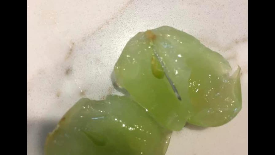 Mujer encuentra aguja dentro de una uva comprada en un supermercado de Australia 