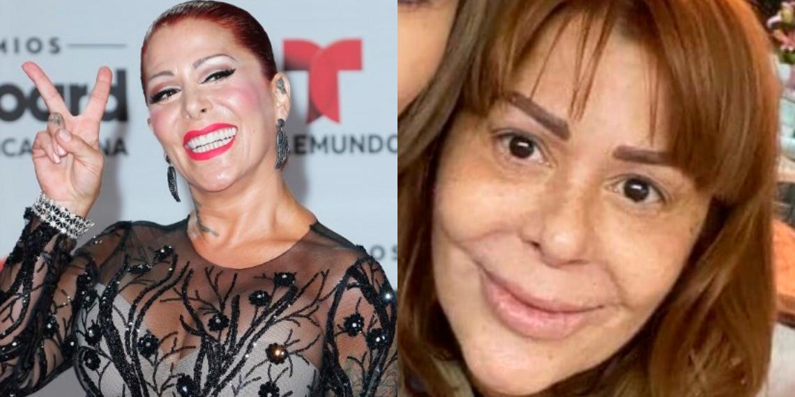 ¿Exceso de cirugías? Critican a Alejandra Guzmán por imagen de su rostro irreconocible
