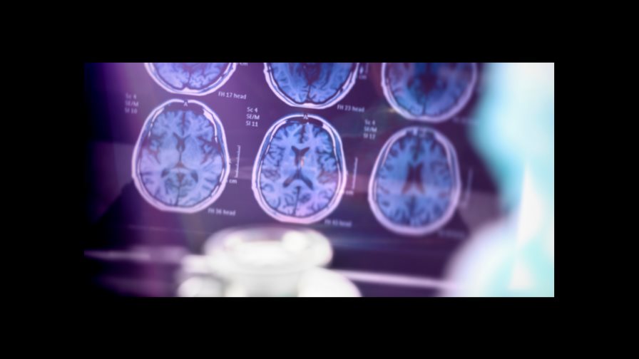 Alzhéimer, escritura correcta