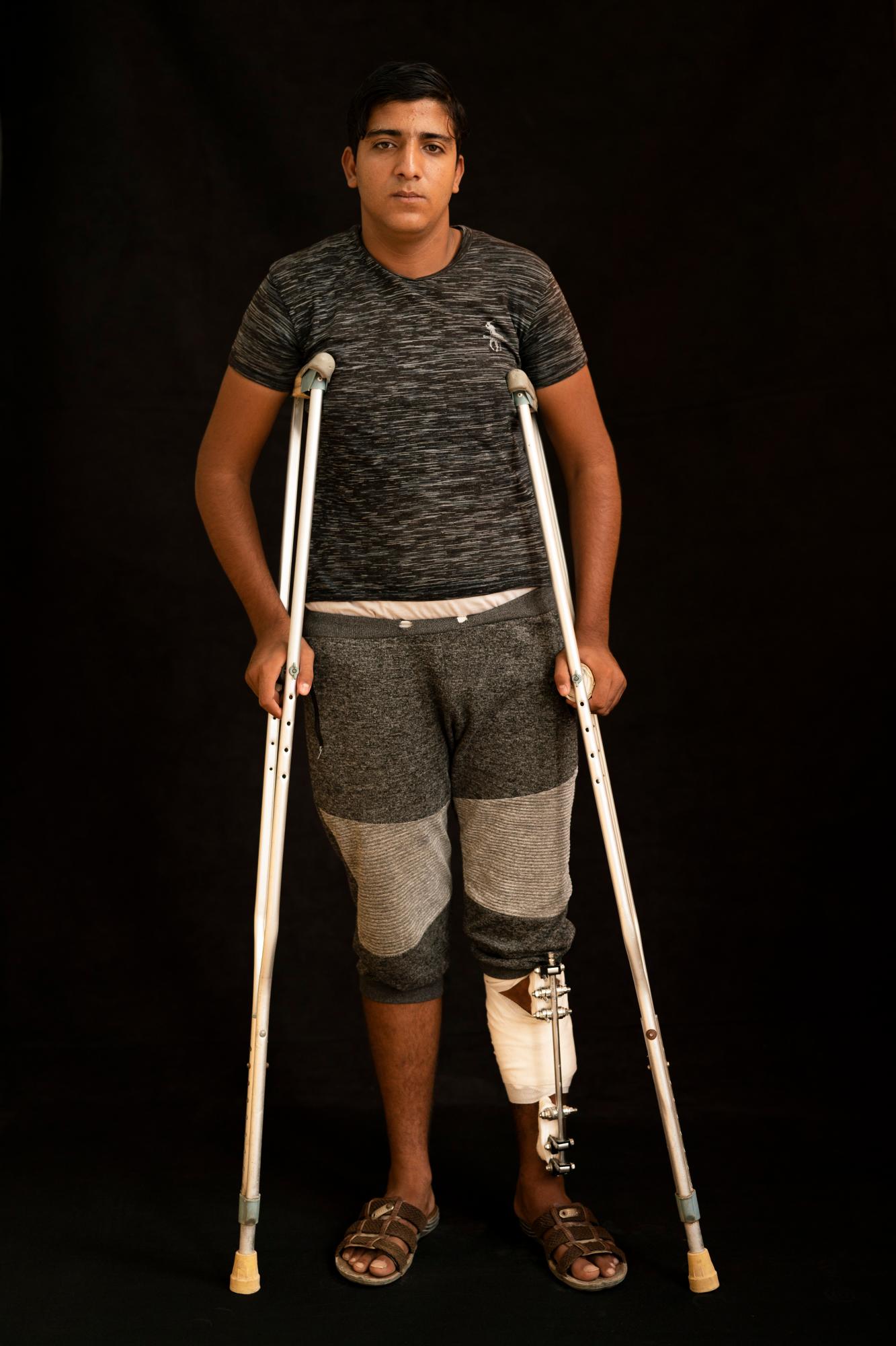 Mahmoud 19,  dice que perdió alrededor de 10 centímetros (cuatro pulgadas) de hueso por sus lesiones y está lejos de recuperarse cinco meses después.
