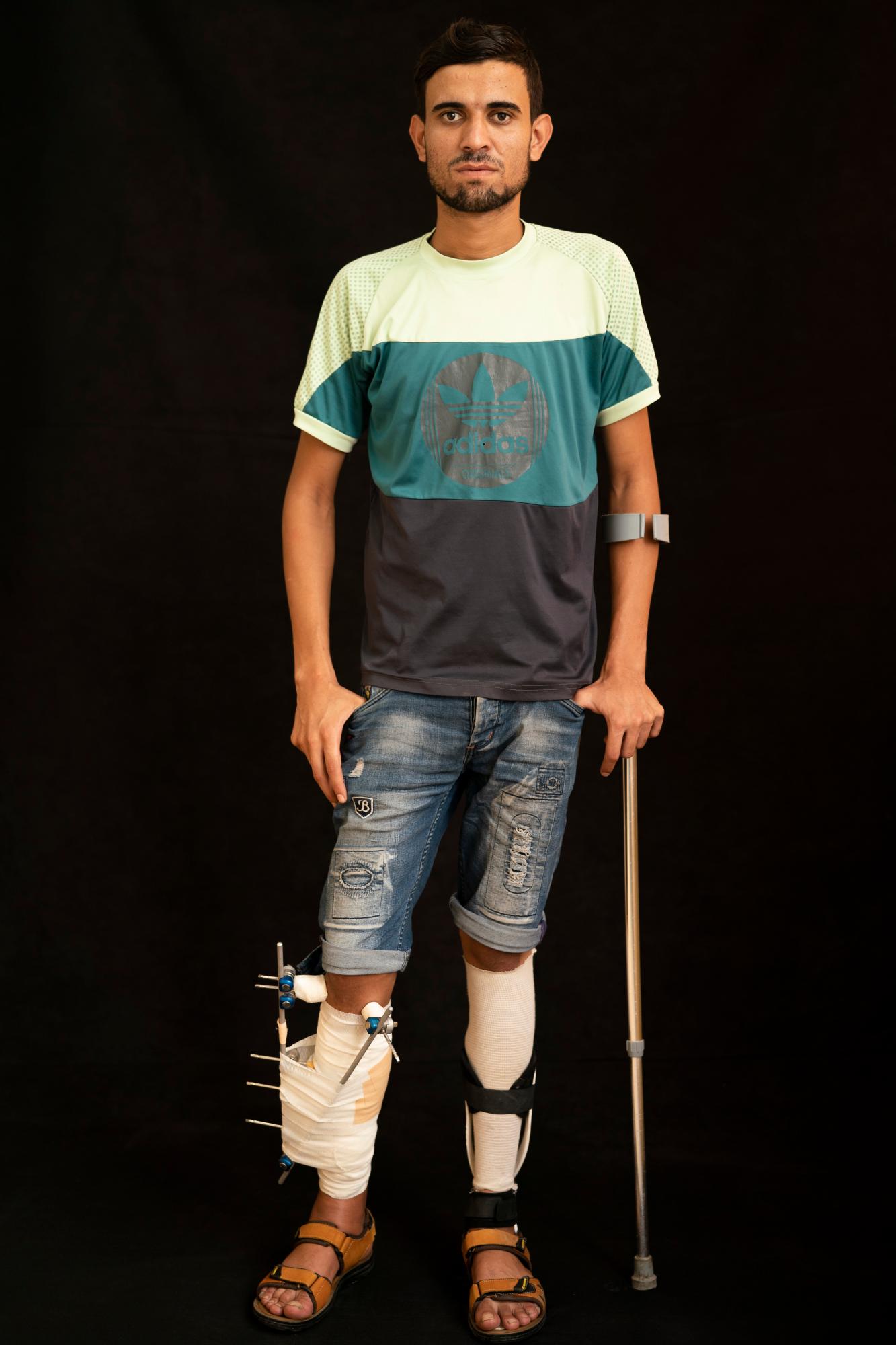 Mohammed al-Eissawi, de 24 años, dice que estaba lanzando piedras con un tirachinas cuando le dispararon en la pierna varias veces. Él ha estado protestando durante cinco años y ha sido herido muchas veces. Dice que no tiene miedo y seguirá participando en las protestas.