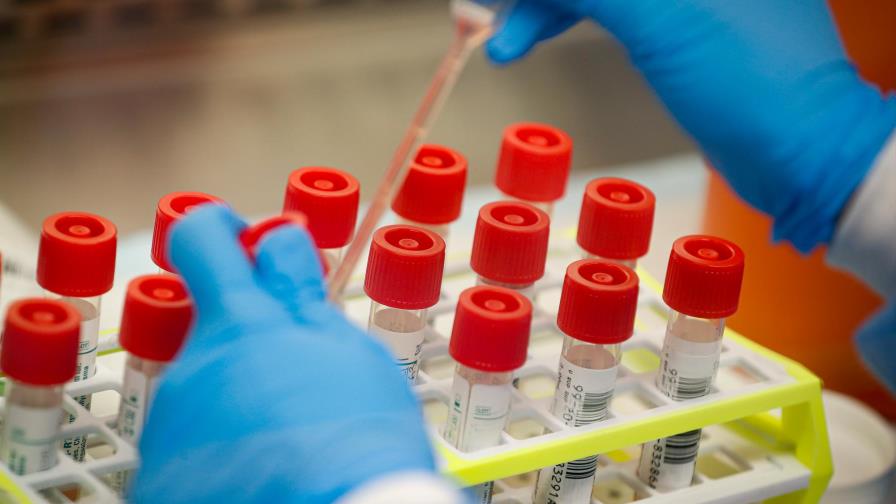 EE.UU. supera los 161.000 muertos y 4,92 millones de contagios de COVID-19