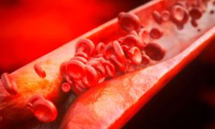 Aterosclerosis subclínica