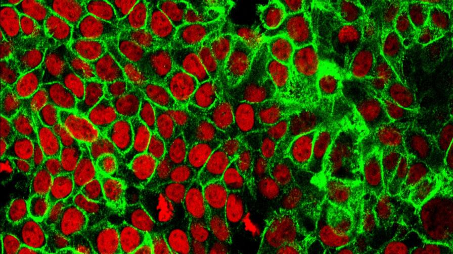 Recomiendan hacerse prueba de detección de cáncer de colon desde los 45 años