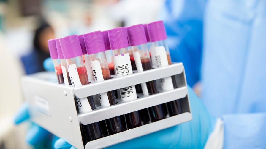 Ministro de Salud Pública defiende el uso de pruebas rápidas