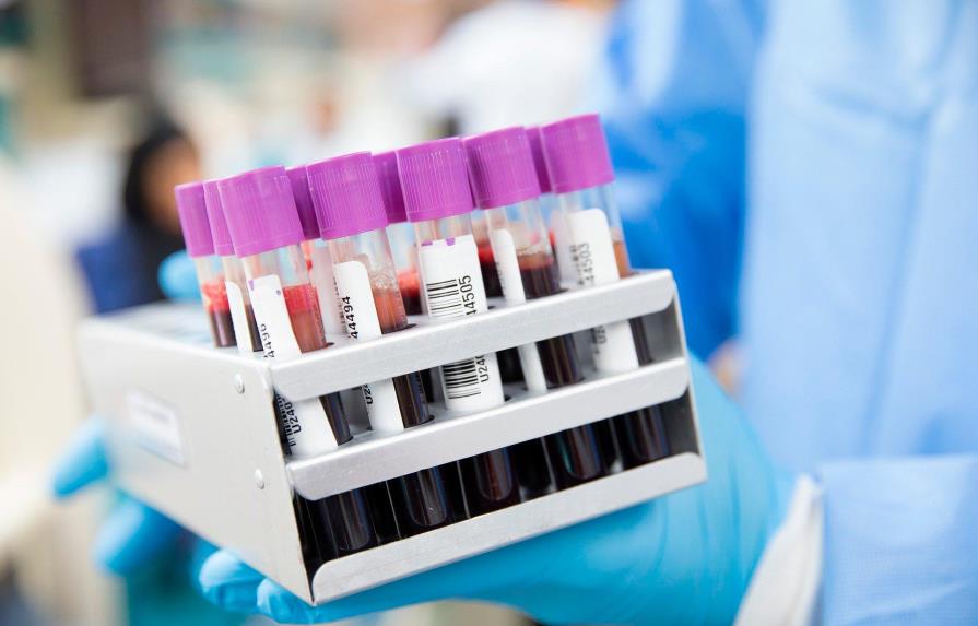 Estudio detecta diferencias en sangre de pacientes graves y leves de COVID-19
