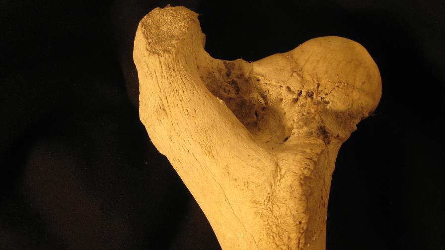 Identifican cáncer avanzado en hueso de un dinosaurio