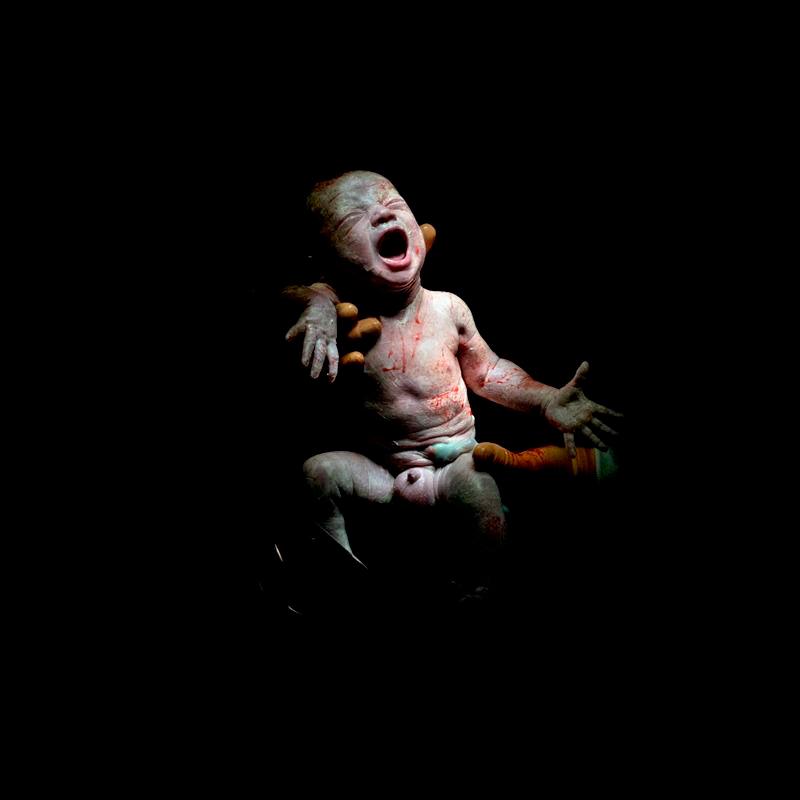 CESAR # 9 - Maël. Nació el 13 de diciembre de 2013 a las 4:52 p.m. 2,8 kg, 18 segundos de vida. 