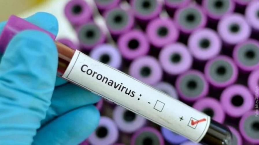 Medidas “urgentes” que propone la Sociedad de Infectología al presidente para enfrentar el COVID-19 