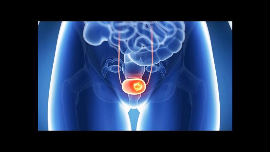 Disminuye el cáncer de cérvix por el VPH pero aumentan otros relacionados