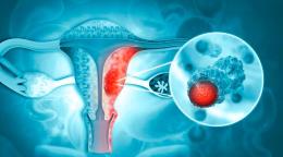 El c&aacute;ncer es la principal causa de muerte entre los hispanos de EE. UU., seg&uacute;n un estudio