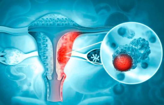 El c&aacute;ncer es la principal causa de muerte entre los hispanos de EE. UU., seg&uacute;n un estudio