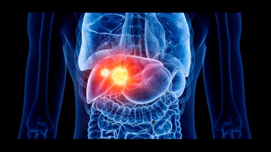 No vacunarse contra hepatitis B puede derivar en cirrosis o cáncer
