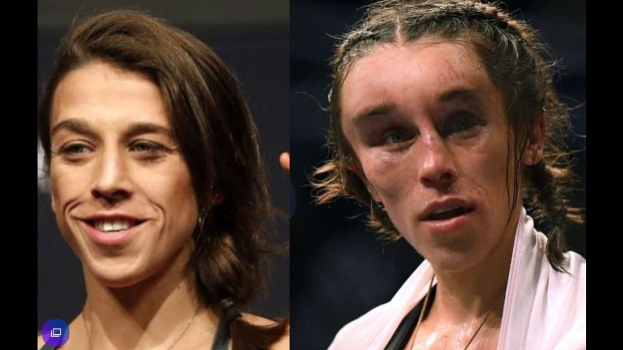 Así quedó la  peleadora polaca Joanna Jedrzejczyk tras un combate en la UFC
