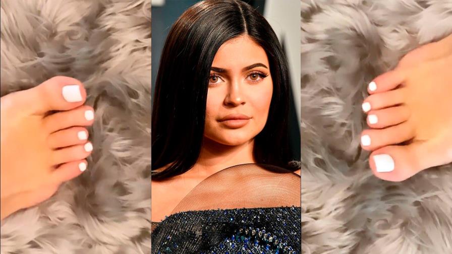 Kylie Jenner explota ante las criticas por la deformación en uno de los dedos de su pie