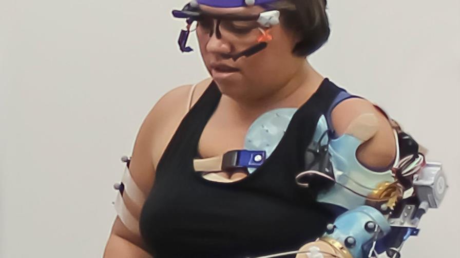 Cleveland Clinic diseña brazo biónico