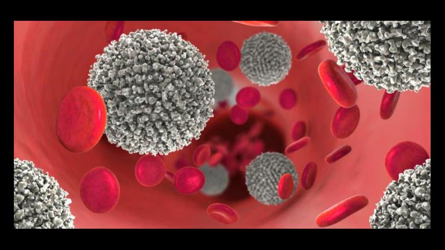 Fundación Un Amigo Como Tú llama a la prevención y atención temprana de la leucemia mieloide aguda