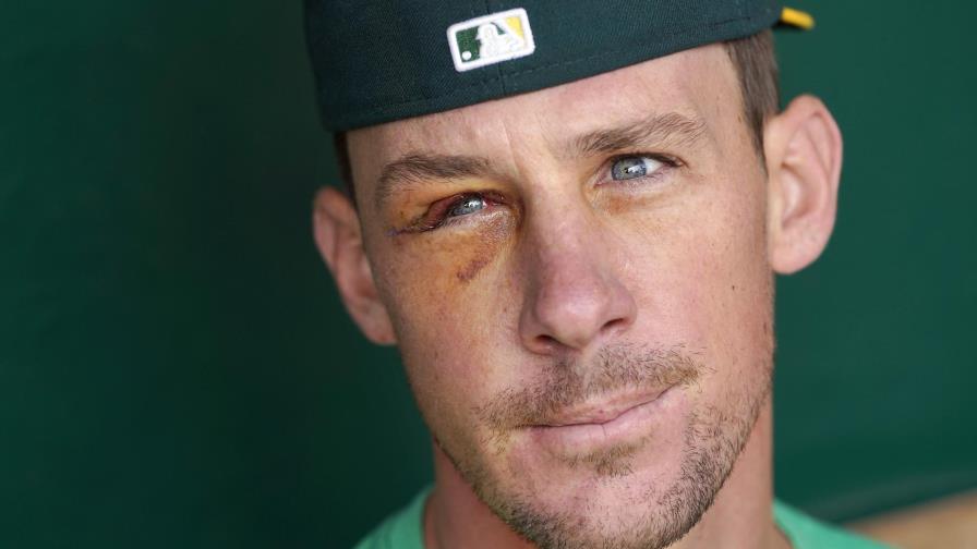 Bassitt listo para volver tras milagrosa recuperación