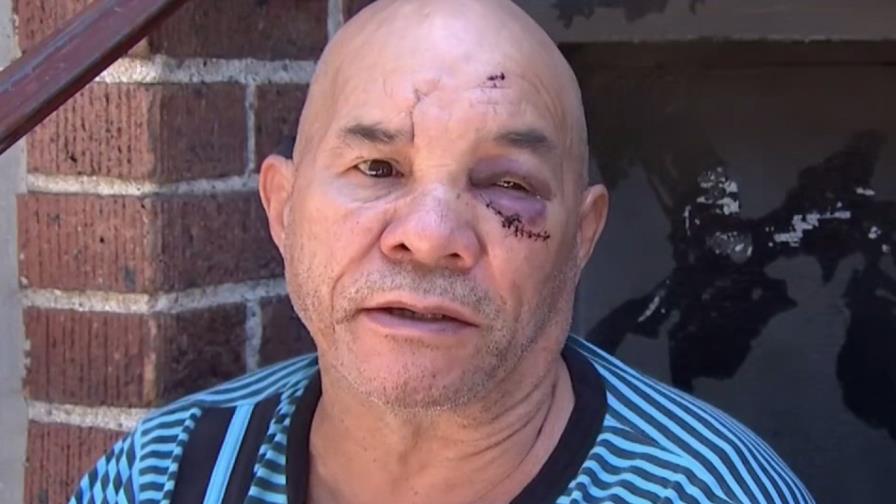 Dan paliza a dominicano en El Bronx tras discusión por escándalos frente a su edificio Dan paliza a dominicano en El Bronx tras discusión por escándalos frente a su edificio