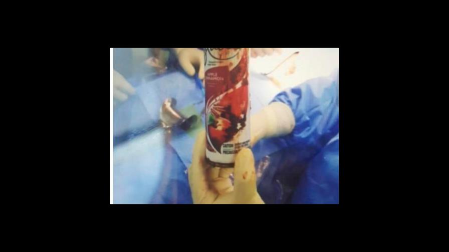 Critican que Moscoso Puello diera a conocer hasta la foto de cirugía a hombre con frasco en el recto Critican que Moscoso Puello diera a conocer hasta la foto de cirugía a hombre con frasco en el recto