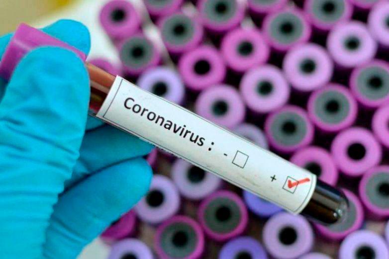Multan con diez mil dólares a un infectado de coronavirus por ocultar los síntomas en Taiwán  