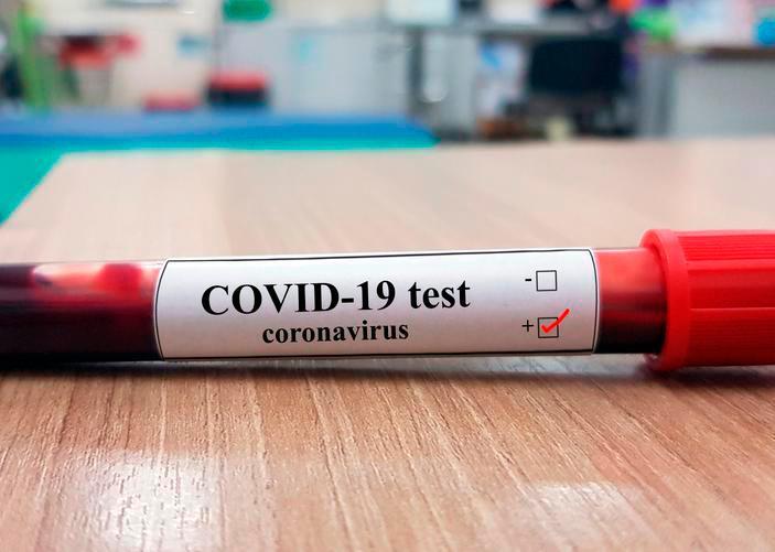 Dan positivo a coronavirus dos ancianos en asilo de Cotuí