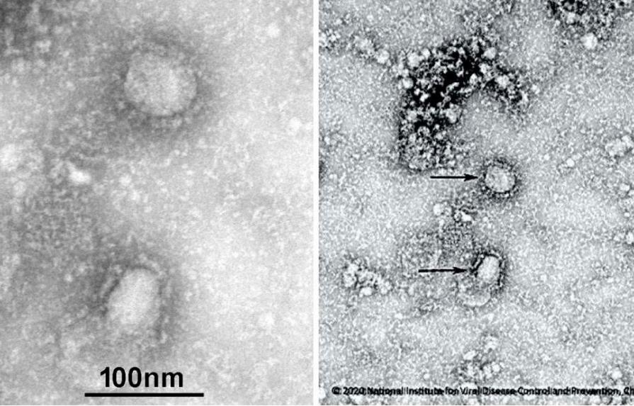 Publican primeras imágenes del coronavirus 