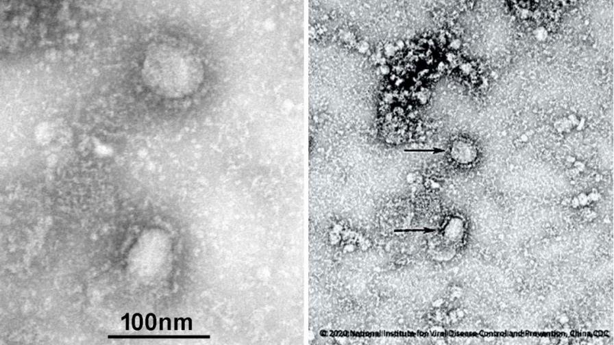 Publican primeras imágenes del coronavirus Publican primeras imágenes del coronavirus