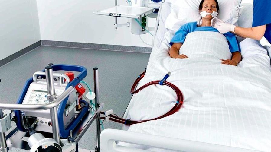 Usan oxigenación extracorpórea para mantener vivos a pacientes COVID-19
