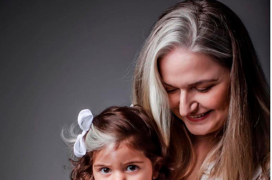 Una niña brasileña nace con canas debido a una rara condición genética 