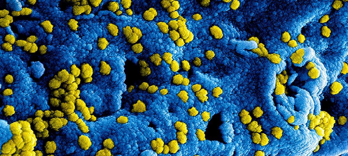 La OMS dice que es demasiado pronto para determinar el origen del nuevo coronavirus