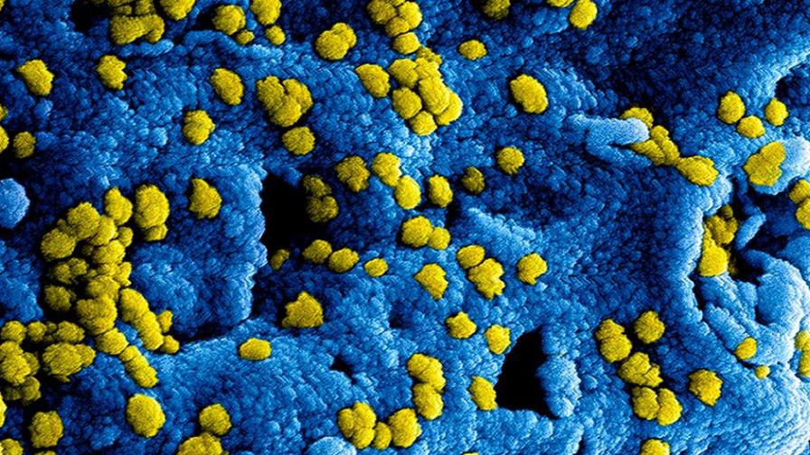 La OMS dice que es demasiado pronto para determinar el origen del nuevo coronavirus