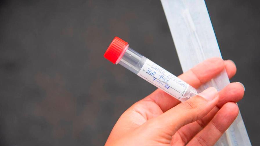 Salud Pública notifica 4,936 casos activos de coronavirus en el país 