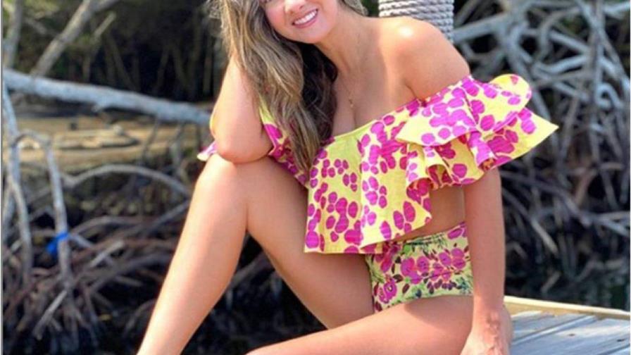 ExMiss Colombia compartirá lo aprendido por la amputación de su pierna en TV