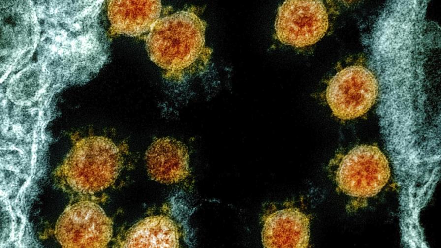 Estudios hallan que cáncer y COVID-19 son mezcla peligrosa Estudios hallan que cáncer y COVID-19 son mezcla peligrosa