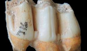 El zinc del esmalte dental, clave para saber la dieta de seres prehist&oacute;ricos