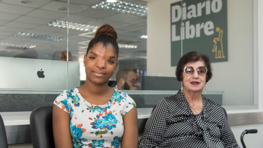 Joven estudiante necesita ayuda para cirugía correctiva de hipertelorismo Joven estudiante necesita ayuda para cirugía correctiva de hipertelorismo