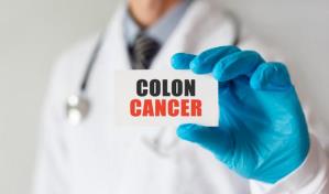 El cáncer colorrectal es el segundo más mortal