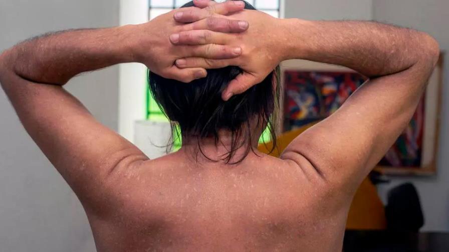 Impotencia sexual y necrosis otras dos secuelas silenciosas del consumo de cocaína 