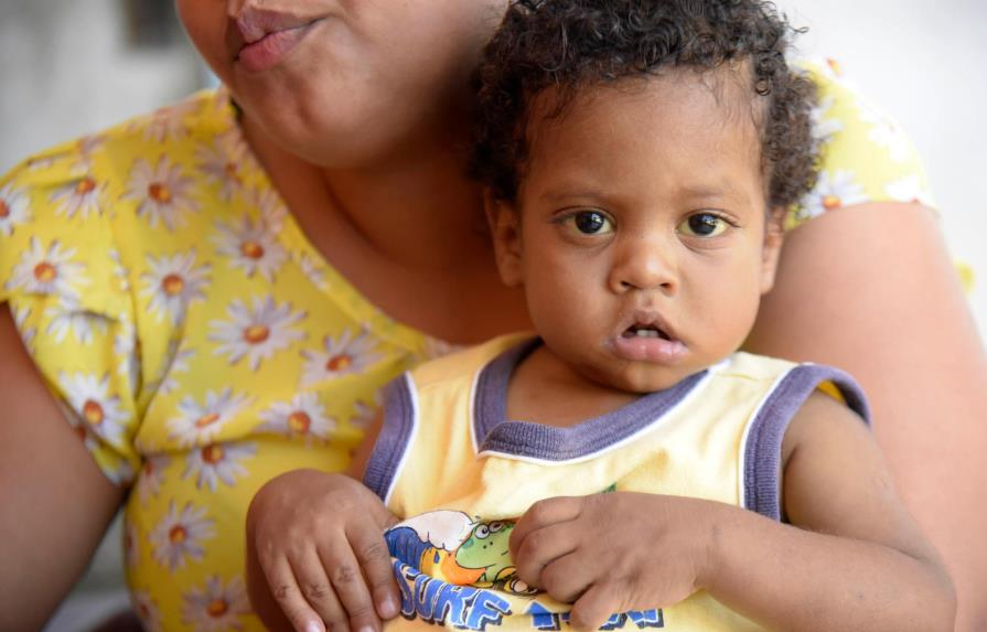 Sadiel Manuel, niño de un año y cuatro meses,  necesita ayuda para trasplante de hígado